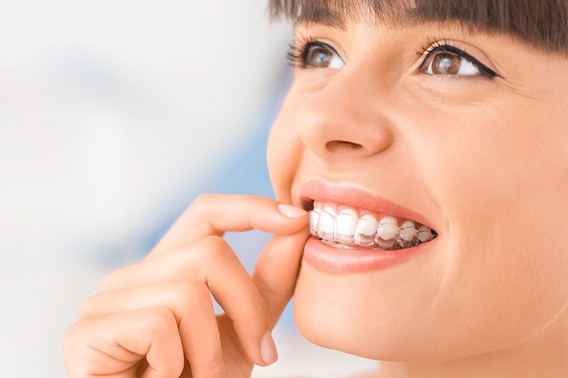 Invisalign in Yuba City