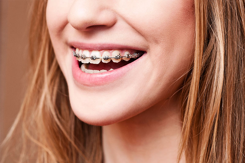 Orthodontics in Yuba City